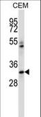 Integrin Binding Sialoprotein antibody, LS-C165101, Lifespan Biosciences, Western Blot image 