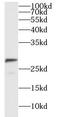 H/ACA ribonucleoprotein complex subunit 1 antibody, FNab03346, FineTest, Western Blot image 