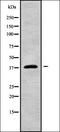 HECT, C2 And WW Domain Containing E3 Ubiquitin Protein Ligase 1 antibody, orb338275, Biorbyt, Western Blot image 