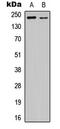 Kinase Insert Domain Receptor antibody, abx121460, Abbexa, Western Blot image 
