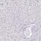 NEFH antibody, HPA061615, Atlas Antibodies, Immunohistochemistry frozen image 
