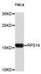 Ribosomal Protein S14 antibody, STJ25400, St John