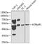ATPase H+ Transporting Accessory Protein 1 antibody, GTX30076, GeneTex, Western Blot image 