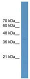 ETS Transcription Factor ELK4 antibody, TA329226, Origene, Western Blot image 