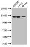Heat-stable enterotoxin receptor antibody, CSB-PA010053LA01HU, Cusabio, Western Blot image 