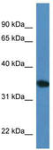Uridine Phosphorylase 2 antibody, TA330993, Origene, Western Blot image 