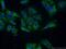 Tumor Suppressor 2, Mitochondrial Calcium Regulator antibody, 11538-1-AP, Proteintech Group, Immunofluorescence image 