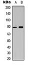 BCL6 Transcription Repressor antibody, orb304698, Biorbyt, Western Blot image 