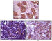 BLK Proto-Oncogene, Src Family Tyrosine Kinase antibody, abx010468, Abbexa, Western Blot image 