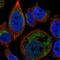 Graves disease carrier protein antibody, PA5-65169, Invitrogen Antibodies, Immunofluorescence image 