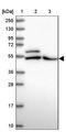 ADP Dependent Glucokinase antibody, NBP1-91653, Novus Biologicals, Western Blot image 