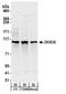 Probable ATP-dependent RNA helicase DHX36 antibody, A300-525A, Bethyl Labs, Western Blot image 
