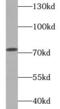 Dopamine Beta-Hydroxylase antibody, FNab02511, FineTest, Western Blot image 