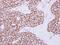 hRAD50 antibody, PA5-31554, Invitrogen Antibodies, Immunohistochemistry paraffin image 