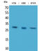 BRMS1 Transcriptional Repressor And Anoikis Regulator antibody, GTX34064, GeneTex, Western Blot image 