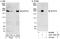Nucleoporin 210 antibody, A301-795A, Bethyl Labs, Western Blot image 