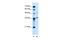 Armadillo Repeat Containing X-Linked 6 antibody, PA5-42600, Invitrogen Antibodies, Western Blot image 