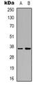 Aldo-keto reductase family 1 member C2 antibody, LS-C368691, Lifespan Biosciences, Western Blot image 
