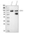 DEAD-Box Helicase 4 antibody, M02448-1, Boster Biological Technology, Western Blot image 