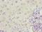 EF-Hand Calcium Binding Domain 12 antibody, A65382-100, Epigentek, Immunohistochemistry paraffin image 
