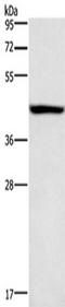 Potassium Voltage-Gated Channel Subfamily J Member 6 antibody, TA351216, Origene, Western Blot image 