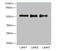 RNA Binding Motif Protein, Y-Linked, Family 1, Member A1 antibody, A57856-100, Epigentek, Western Blot image 