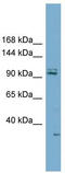 Ring Finger And CCCH-Type Domains 2 antibody, TA329879, Origene, Western Blot image 