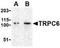 Short transient receptor potential channel 6 antibody, NBP1-77261, Novus Biologicals, Western Blot image 
