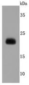 Lipocalin 2 antibody, NBP2-66935, Novus Biologicals, Western Blot image 