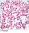 Fatty Acid Binding Protein 5 antibody, orb27768, Biorbyt, Immunohistochemistry paraffin image 
