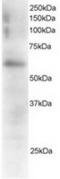 FGR Proto-Oncogene, Src Family Tyrosine Kinase antibody, TA302485, Origene, Western Blot image 