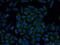 Trefoil Factor 1 antibody, 13734-1-AP, Proteintech Group, Immunofluorescence image 