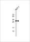 Latexin antibody, 64-154, ProSci, Western Blot image 