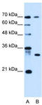 ATPase H+ Transporting Accessory Protein 1 Like antibody, TA336069, Origene, Western Blot image 