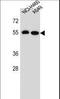 Leucine Rich Repeat Containing 6 antibody, LS-C165890, Lifespan Biosciences, Western Blot image 