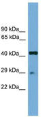 Regulatory Factor X Associated Protein antibody, TA329979, Origene, Western Blot image 
