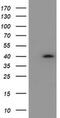Hydroxysteroid 17-Beta Dehydrogenase 2 antibody, MA5-25930, Invitrogen Antibodies, Western Blot image 