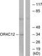 Olfactory Receptor Family 4 Subfamily C Member 12 antibody, TA316298, Origene, Western Blot image 