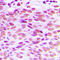 GATA Binding Protein 4 antibody, LS-C353987, Lifespan Biosciences, Immunohistochemistry paraffin image 