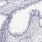 Myopalladin antibody, HPA061494, Atlas Antibodies, Immunohistochemistry frozen image 