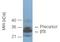 Proteasome Subunit Beta 11 antibody, M11234, Boster Biological Technology, Western Blot image 