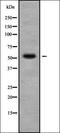 Killer Cell Lectin Like Receptor C2 antibody, orb336339, Biorbyt, Western Blot image 