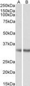 Monoglyceride Lipase antibody, GTX88653, GeneTex, Western Blot image 