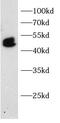 Interferon regulatory factor 5 antibody, FNab10757, FineTest, Western Blot image 