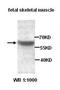 Estrogen Receptor 1 antibody, orb76975, Biorbyt, Western Blot image 