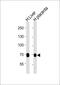 Fms Related Tyrosine Kinase 1 antibody, M00534-1, Boster Biological Technology, Western Blot image 