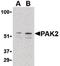 P21 (RAC1) Activated Kinase 2 antibody, orb86735, Biorbyt, Western Blot image 