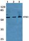 Mst1/Mst2 antibody, A02224, Boster Biological Technology, Western Blot image 