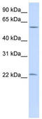 Lin-28 Homolog A antibody, TA335465, Origene, Western Blot image 
