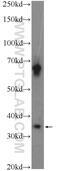 Chromosome 1 Open Reading Frame 56 antibody, 25433-1-AP, Proteintech Group, Western Blot image 